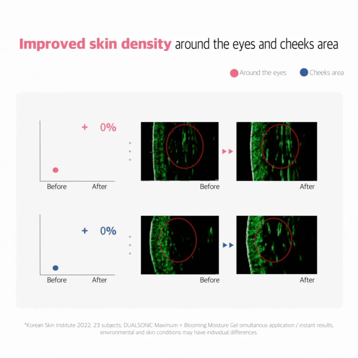DUALSONIC Infiinite Shot & HIFU Maximum Beauty Device