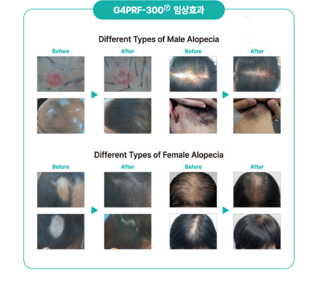 Hairderm 1.8 (Hairderm 1.8)