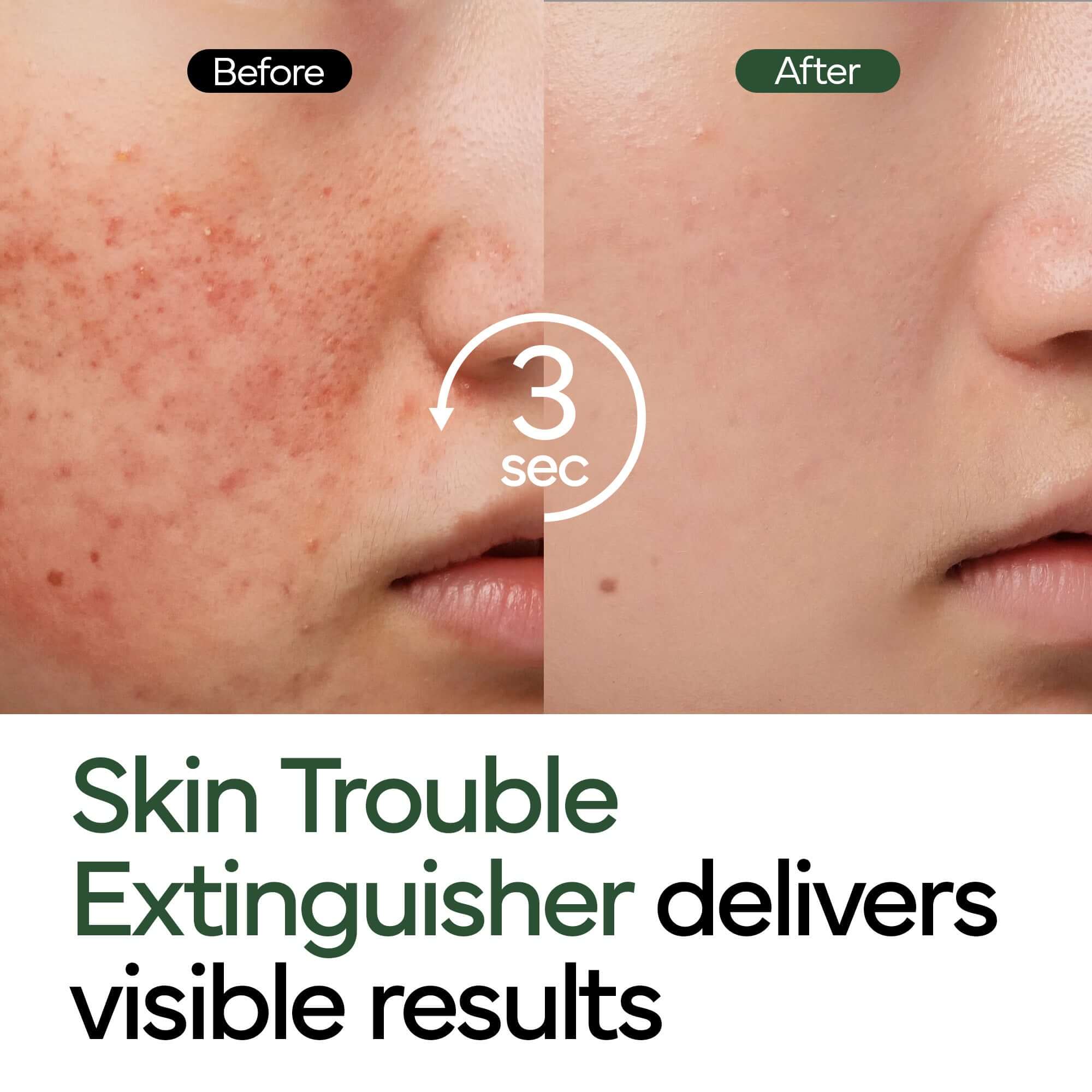 IVOSKIN Intensive Cica Repair Cream