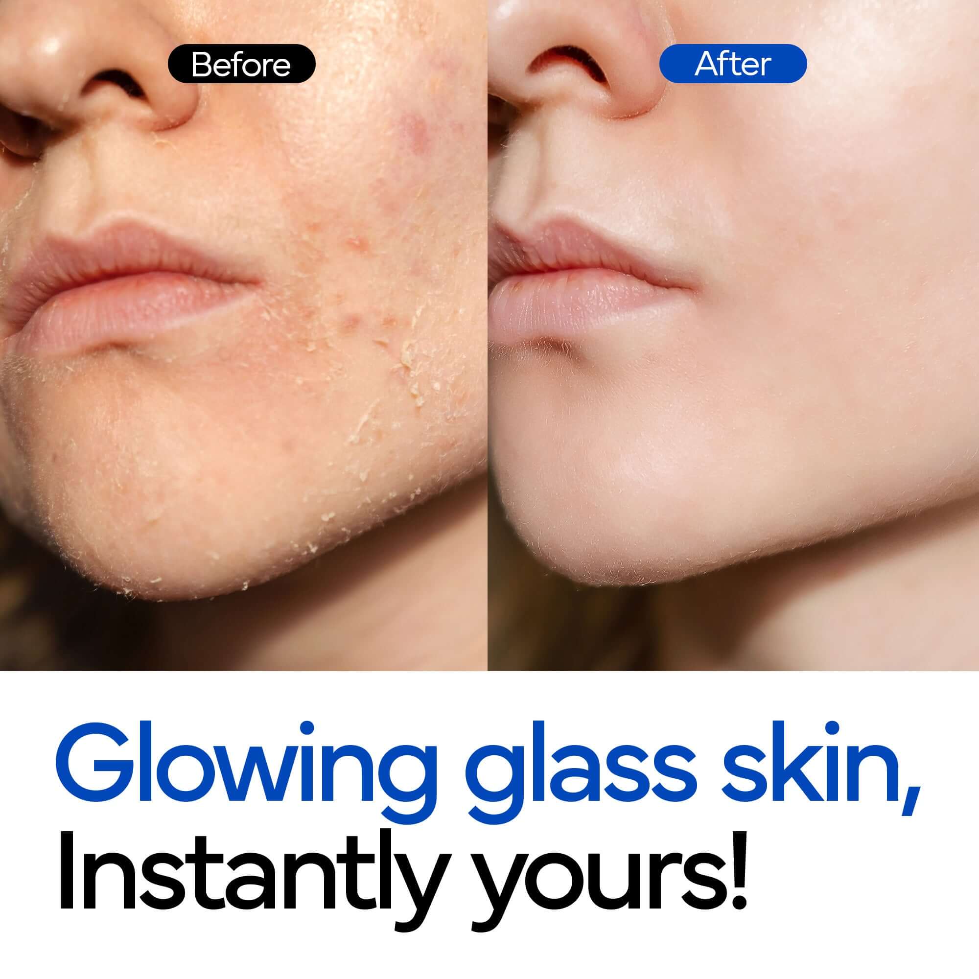 IVOSKIN Hydrating Rice Bubble Toner