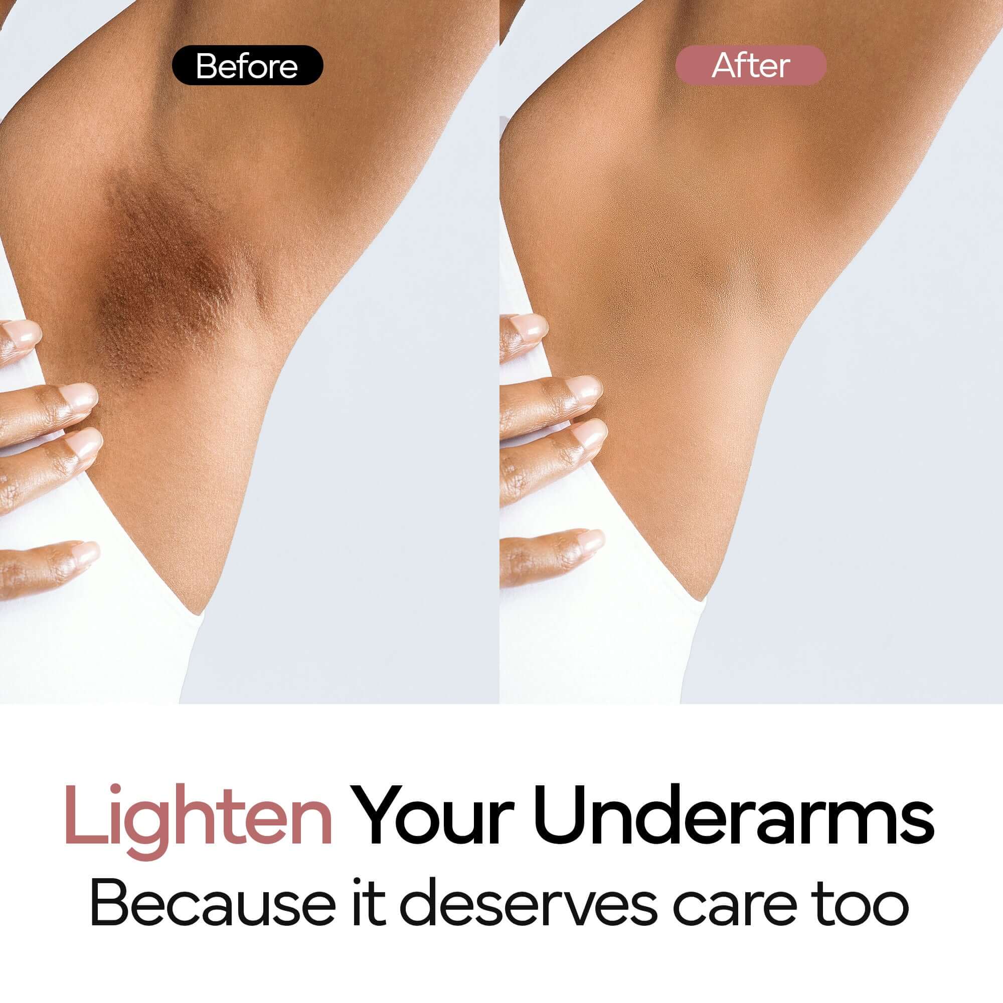 IVOSKIN Natural Deodorant