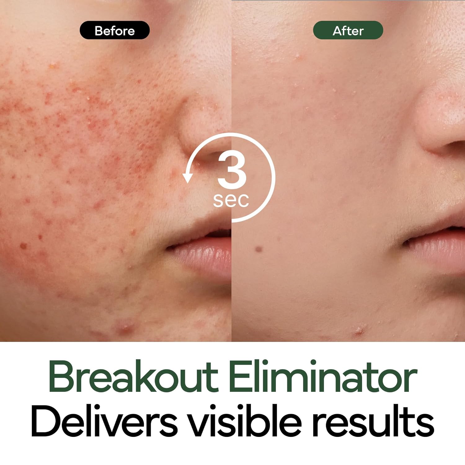 IVOSKIN Repairing Skincare Set