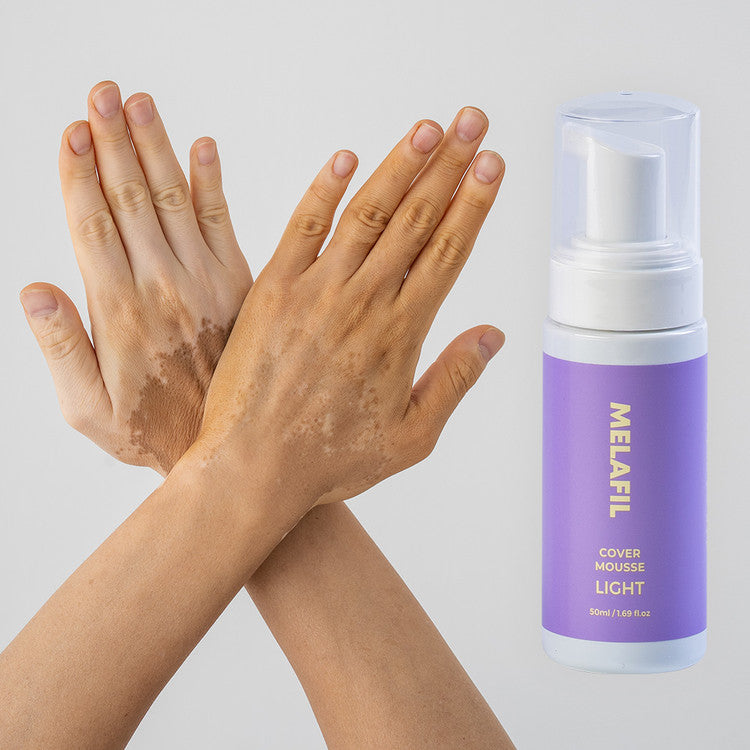 MELAFIL Vitiligo Cover Mousse 50ml