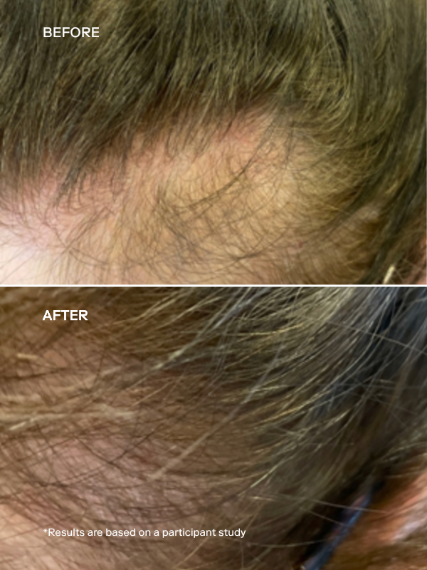 EXO FORTIFY™ Revitalizing Hair & Scalp Treatment