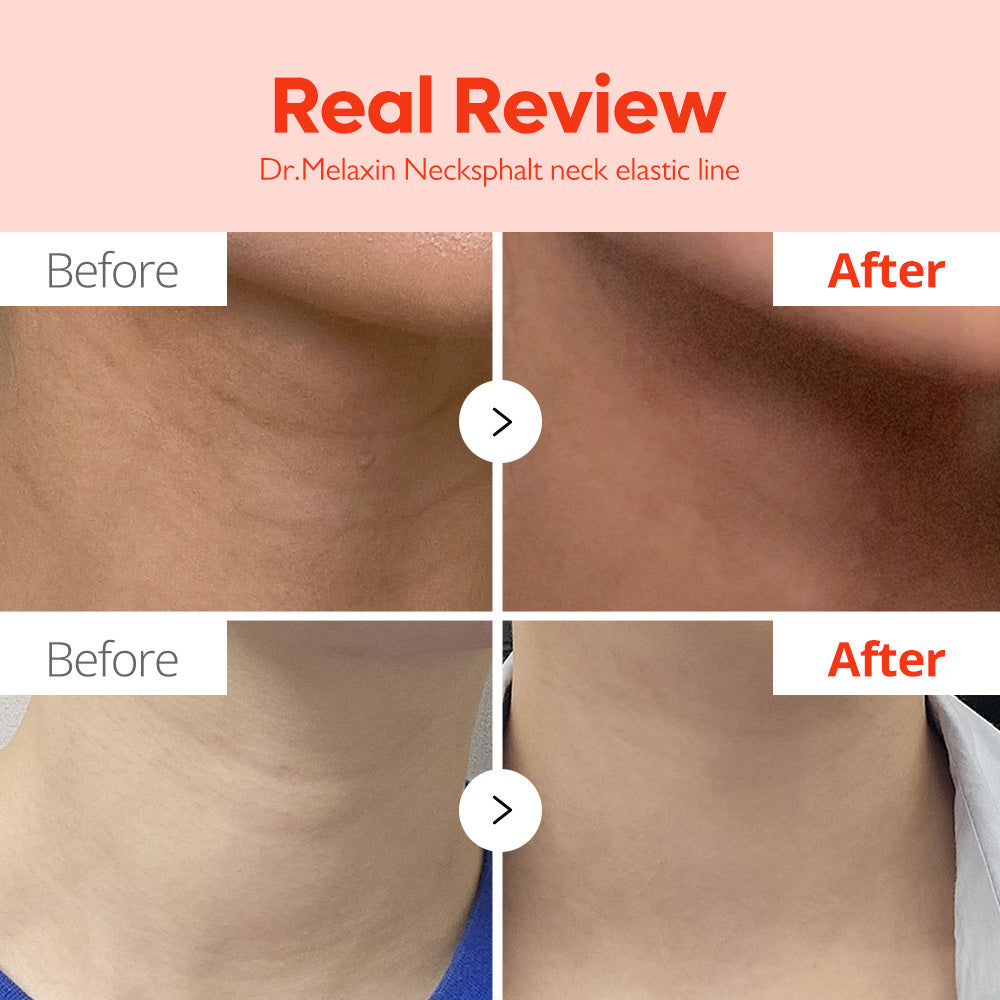 DR.MELAXIN Necksphalt ECM Neck Barrier Ampoule 1.5ml - KBEAUTY X