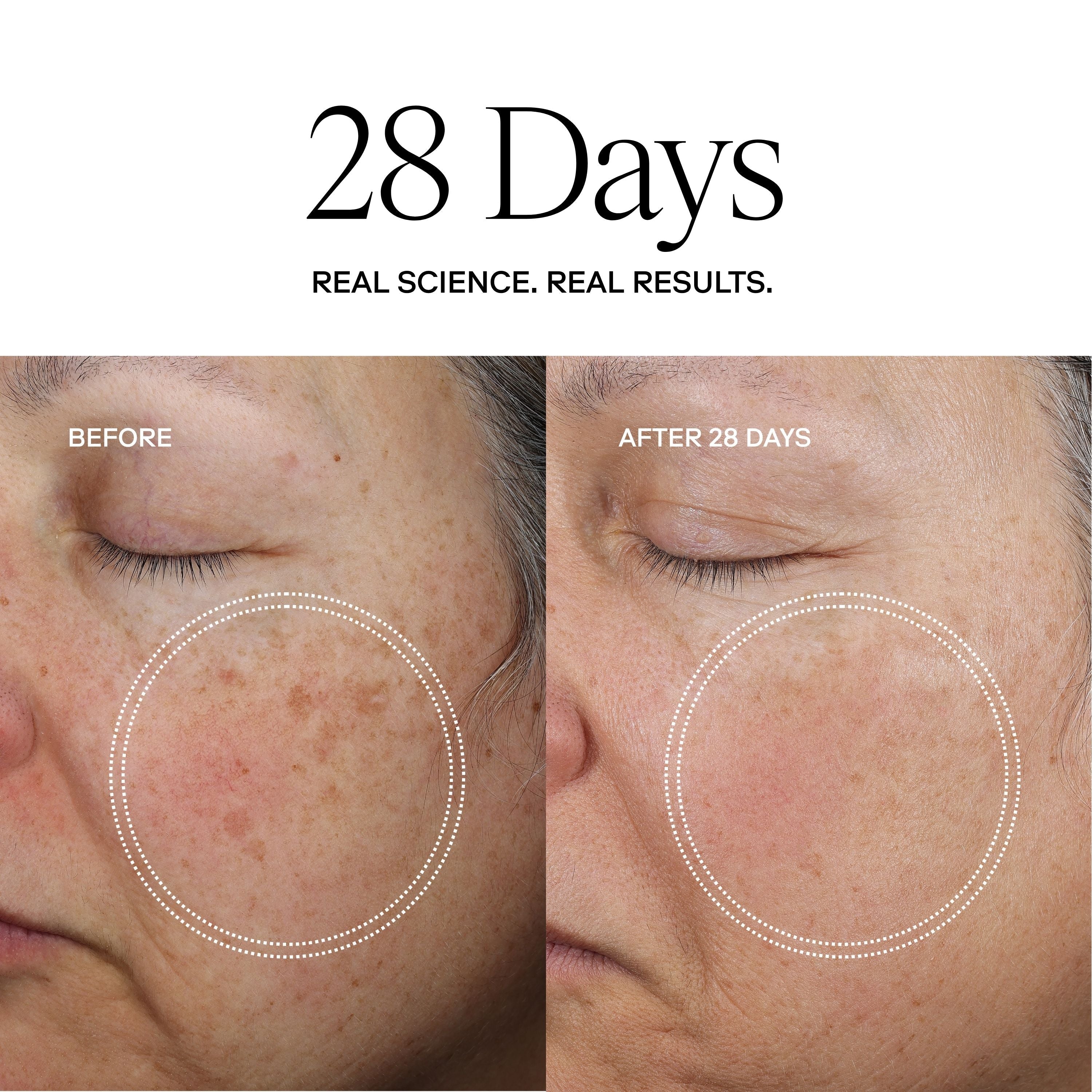 EXO FACE® Perfection Moisturizer / eXo³ Exosomes®
