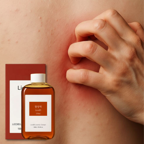 Jinyang Soothing Spray 150ml | LicoB5™ Patented Complex for Hypersensitive, Atopic & Itchy Skin Relief