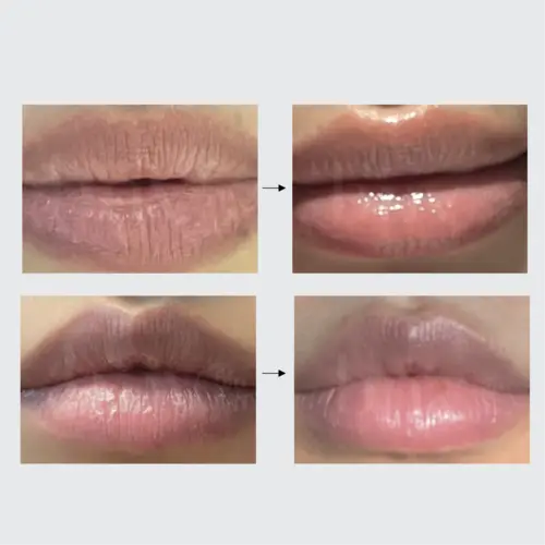 BNV Lip Ointment (BNV Lip)