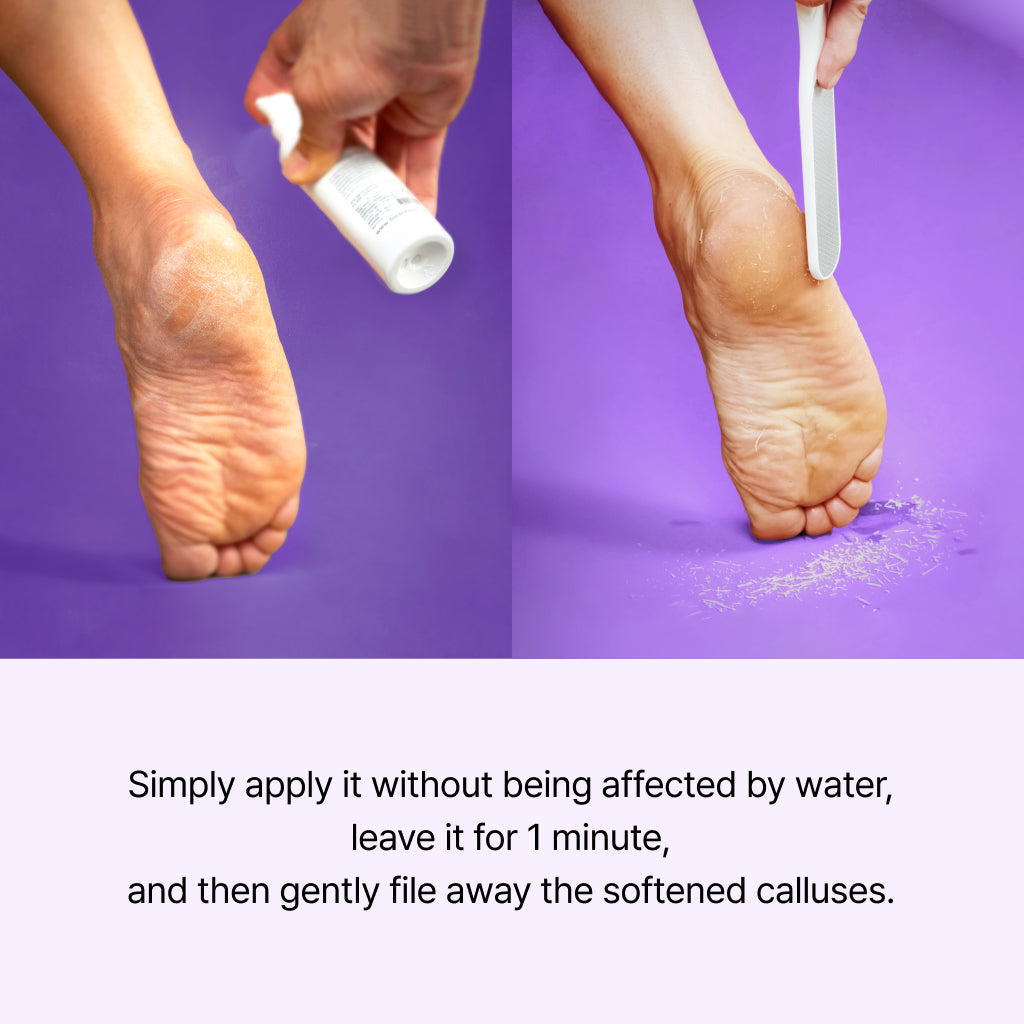 [BAREN] Callus Remover Peeling Foot Spray, 100ml