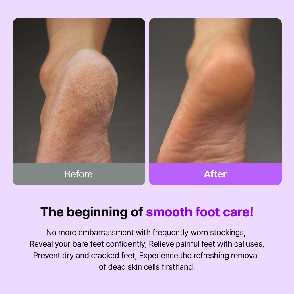 [BAREN] Callus Remover The Whale Foot File