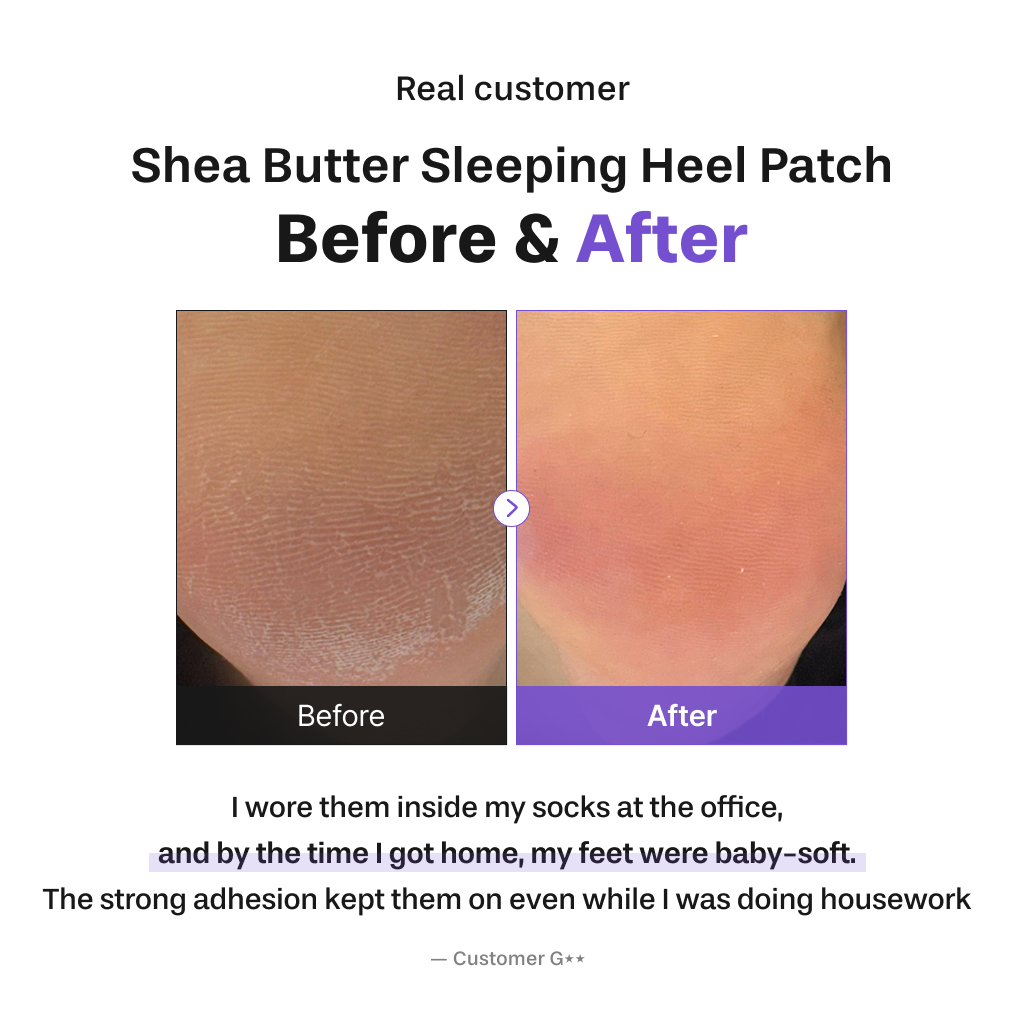 [BAREN] Shea Butter Sleeping Heel Patch, 10pcs