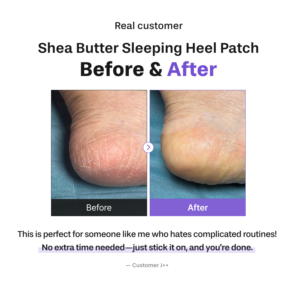 [BAREN] Shea Butter Sleeping Heel Patch, 10pcs