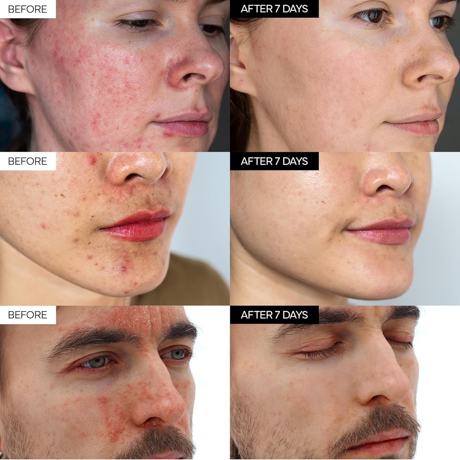 Ivoskin Intensive Cica Repair Cream with Madecassoside (1.76oz / 50g)