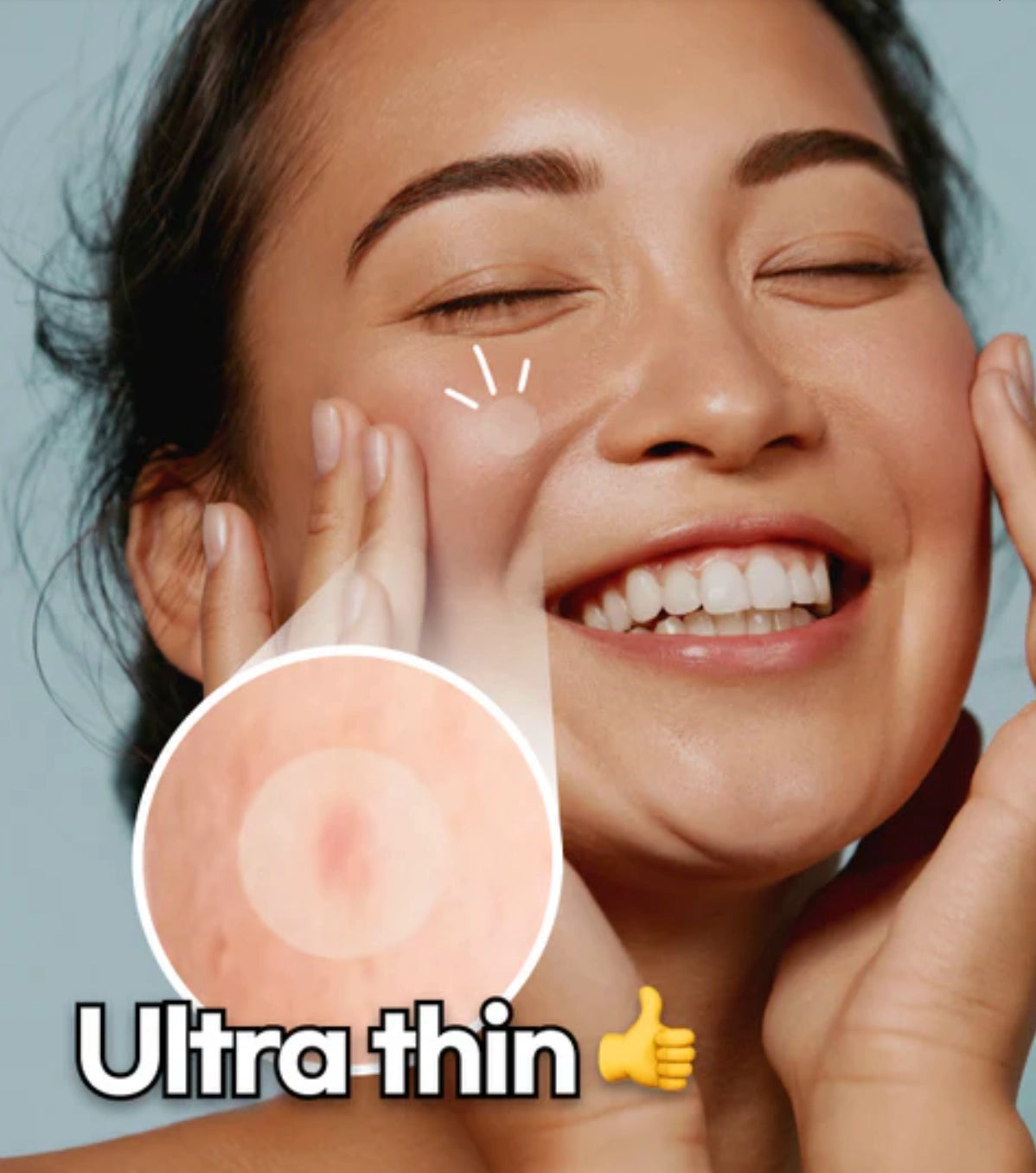 AnyBand Korean Acne Pimple Ultra Thin Patch - 42 patches x 5 packs